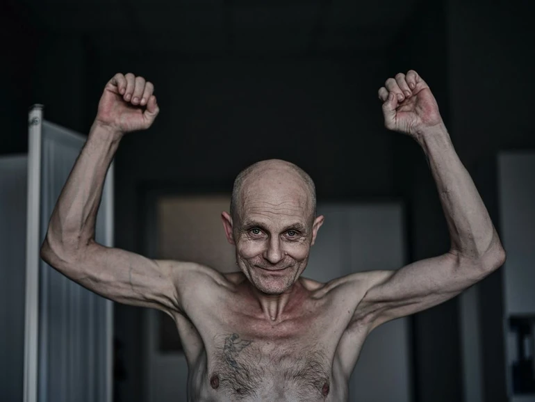 Released prisoner of war, frail and exhausted, raising his hands